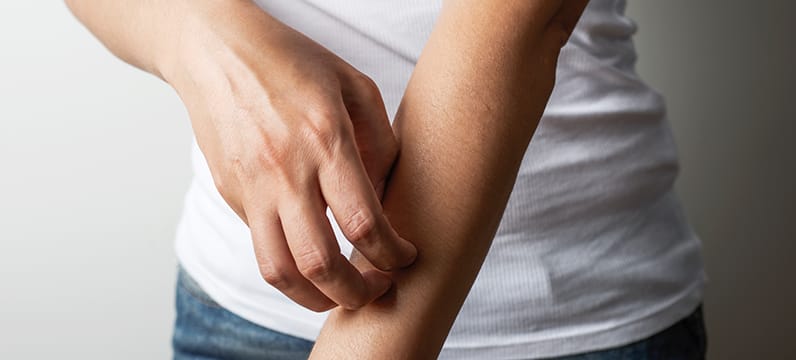 Skin Allergy Test & Treatment South Miami FL