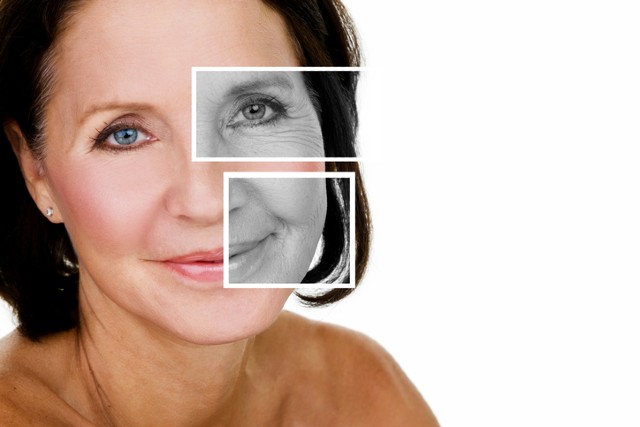 Botox® Injections Miami, TX