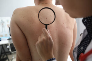 Mole Check South Miami FL
