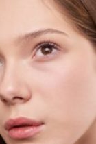 Laser Skin Rejuvenation Treatment Pinecrest FL