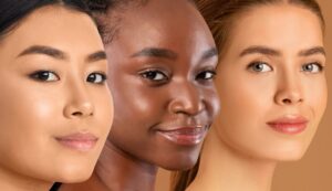 Even Skin Tone Results After Xtrac Treatment in South Miami